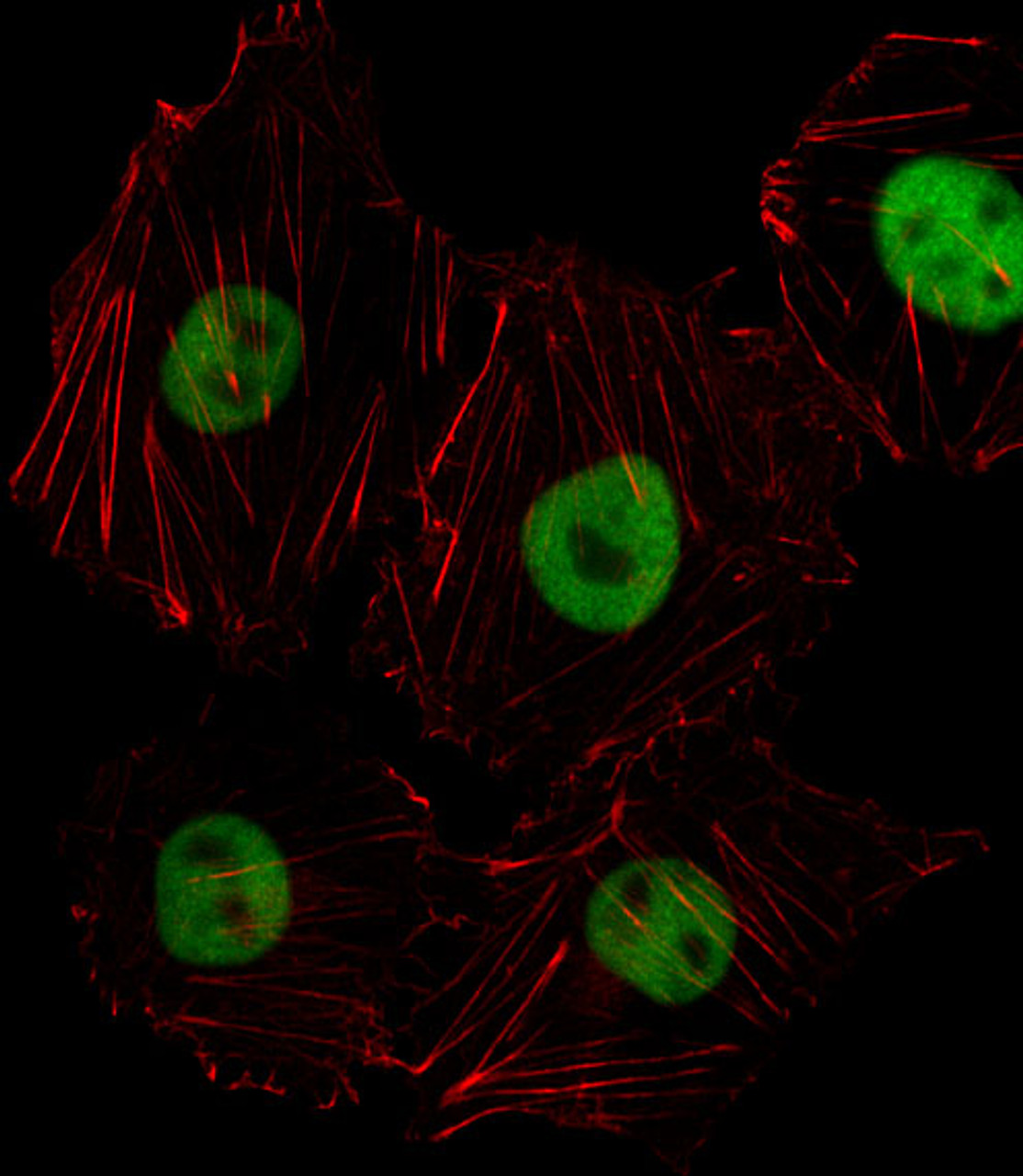 Fluorescent image of HUVEC cell stained with HOXD8 Antibody .HUVEC cells were fixed with 4% PFA (20 min) , permeabilized with Triton X-100 (0.1%, 10 min) , then incubated with HOXD8 primary antibody (1:25) . For secondary antibody, Alexa Fluor 488 conjugated donkey anti-rabbit antibody (green) was used (1:400) .Cytoplasmic actin was counterstained with Alexa Fluor 555 (red) conjugated Phalloidin (7units/ml) .HOXD8 immunoreactivity is localized to Nucleus significantly.