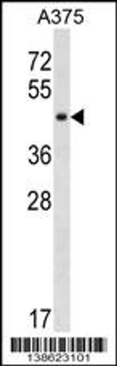 Western blot analysis in A375 cell line lysates (35ug/lane) .