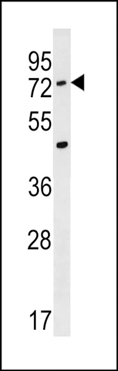 Western blot analysis in A549 cell line lysates (35ug/lane) .This demonstrates the ACSM2A antibody detected the ACSM2A protein (arrow) .