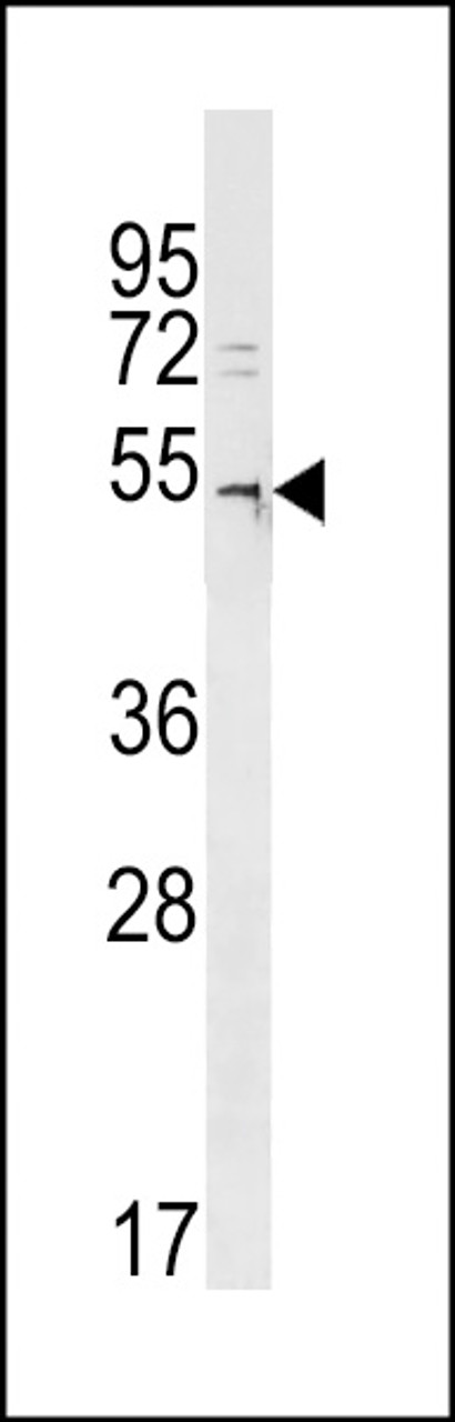 Western blot analysis in A2058 cell line lysates (35ug/lane) .