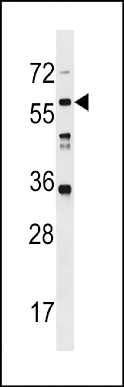 Western blot analysis in WiDr cell line lysates (35ug/lane) .