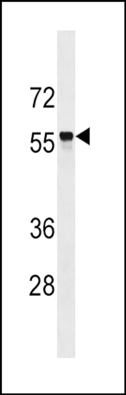 Western blot analysis in CEM cell line lysates (35ug/lane) .