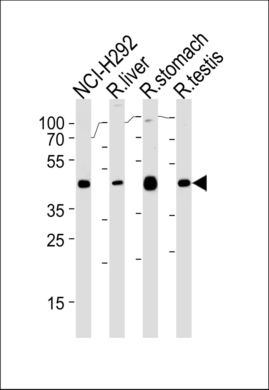 Western blot analysis in NCI-H292, rat liver, stomach and testis cell line lysates (35ug/lane) .