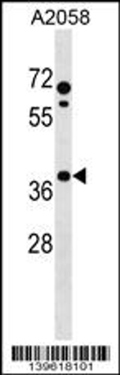 Western blot analysis in A2058 cell line lysates (35ug/lane) .