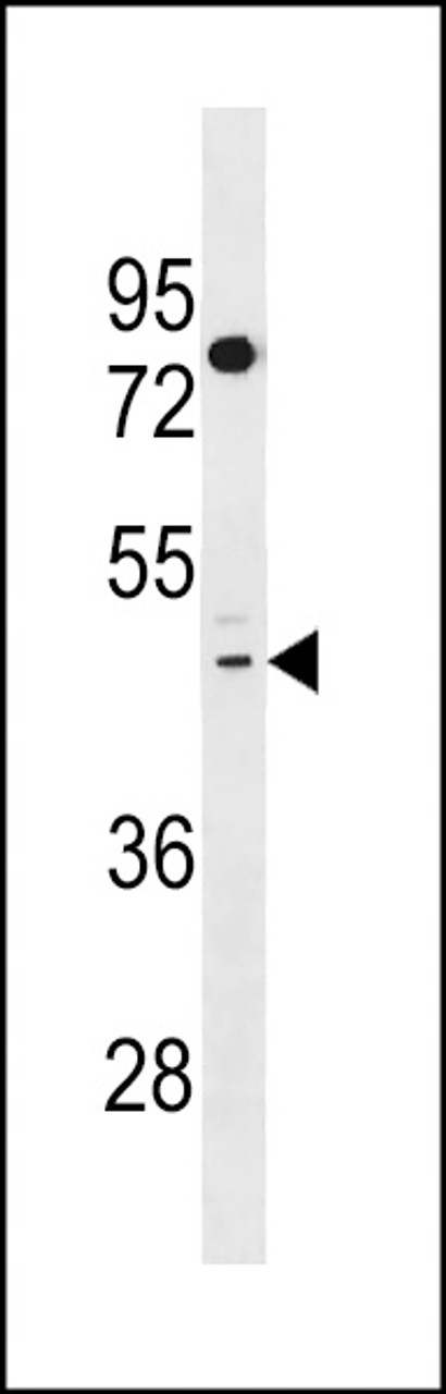 Western blot analysis in HepG2 cell line lysates (35ug/lane) .