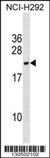 Western blot analysis in NCI-H292 cell line lysates (35ug/lane) .