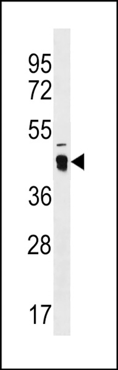 Western blot analysis in WiDr cell line lysates (35ug/lane) .