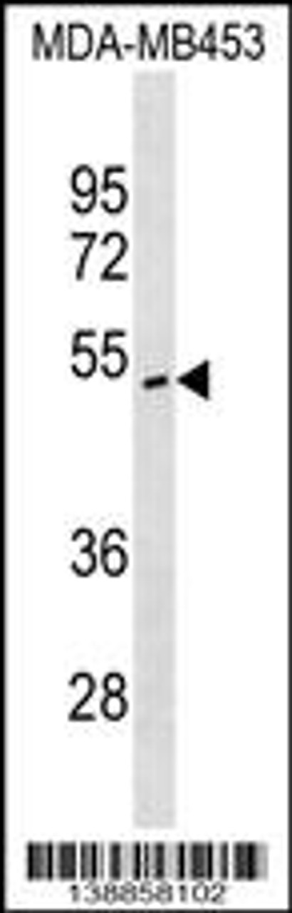 Western blot analysis in MDA-MB453 cell line lysates (35ug/lane) .