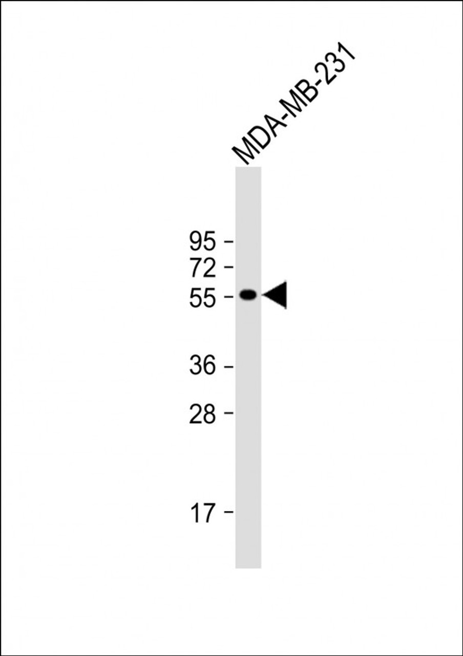 Western Blot at 1:1000 dilution + MDA-MB-231 whole cell lysate Lysates/proteins at 20 ug per lane.