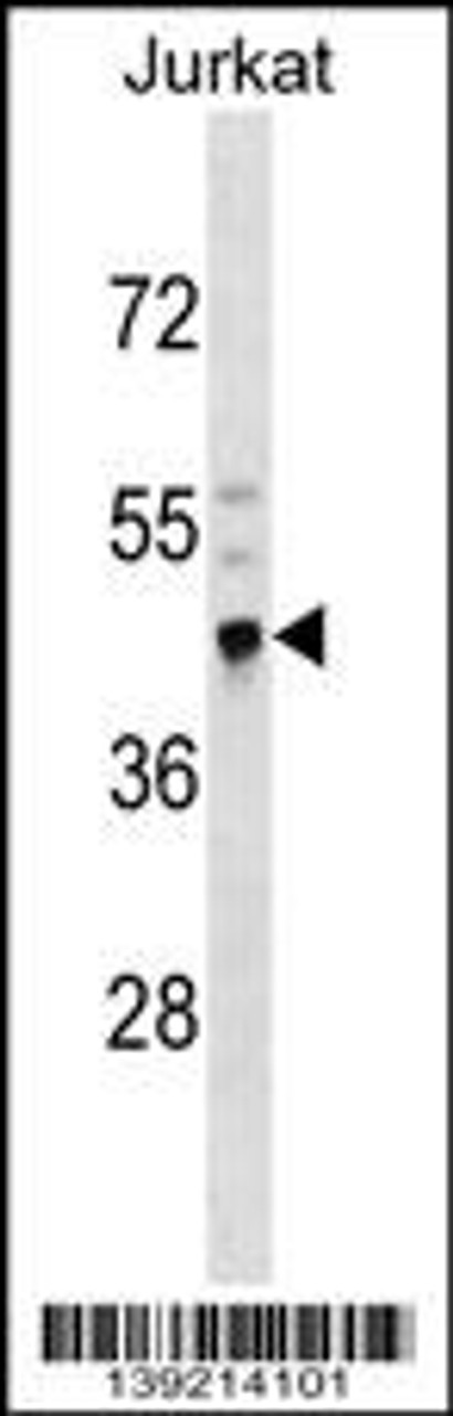 Western blot analysis in Jurkat cell line lysates (35ug/lane) .