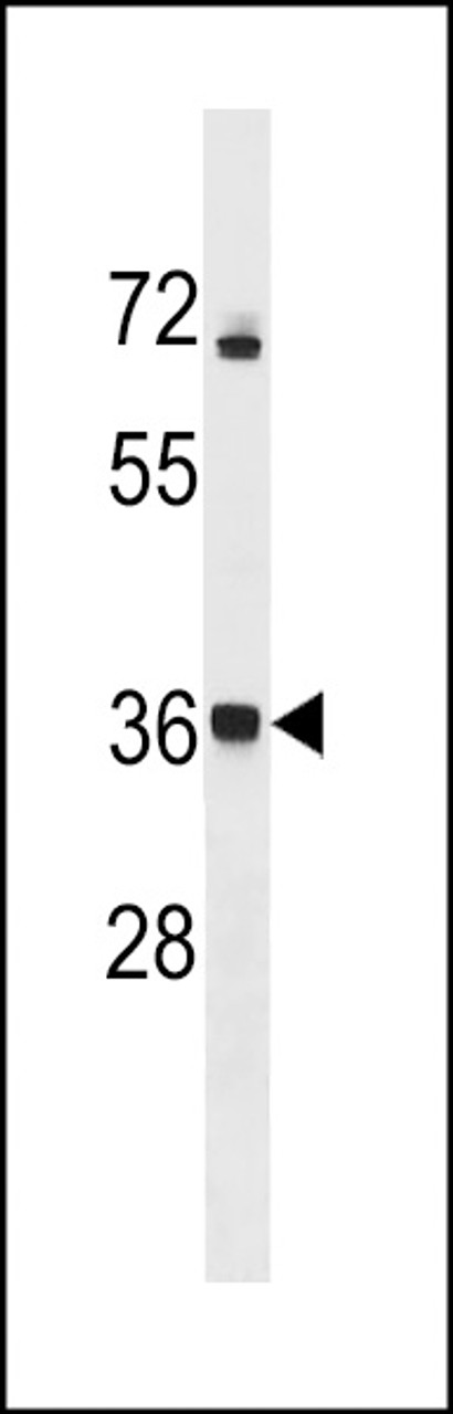 Western blot analysis in A2058 cell line lysates (35ug/lane) .