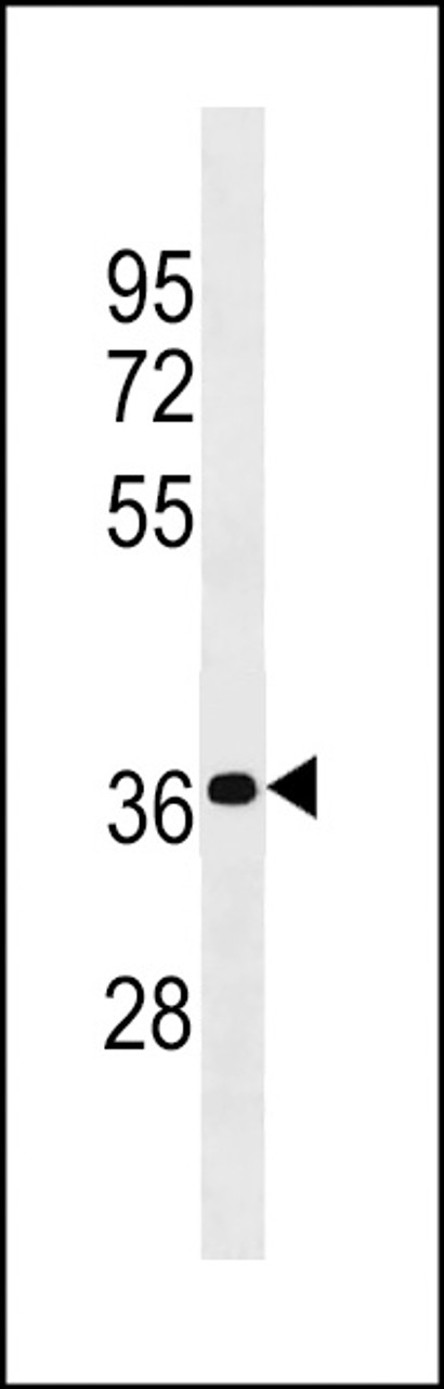 Western blot analysis in MDA-MB453 cell line lysates (35ug/lane) .