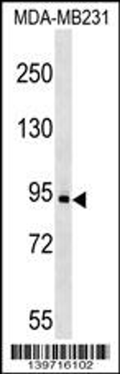 Western blot analysis in MDA-MB231 cell line lysates (35ug/lane) .This demonstrates the KIT antibody detected the KIT protein (arrow) .