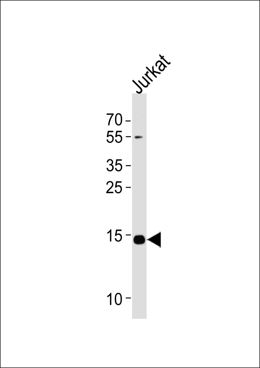 Western blot analysis of lysate from Jurkat cell line, using UBE2D4 Antibody at 1:1000 at each lane.