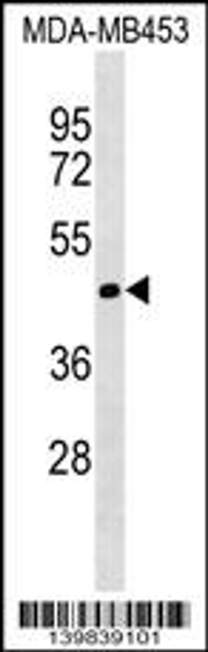 Western blot analysis in MDA-MB453 cell line lysates (35ug/lane) .