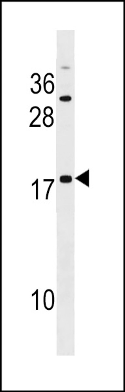 Western blot analysis in HepG2 cell line lysates (35ug/lane) .