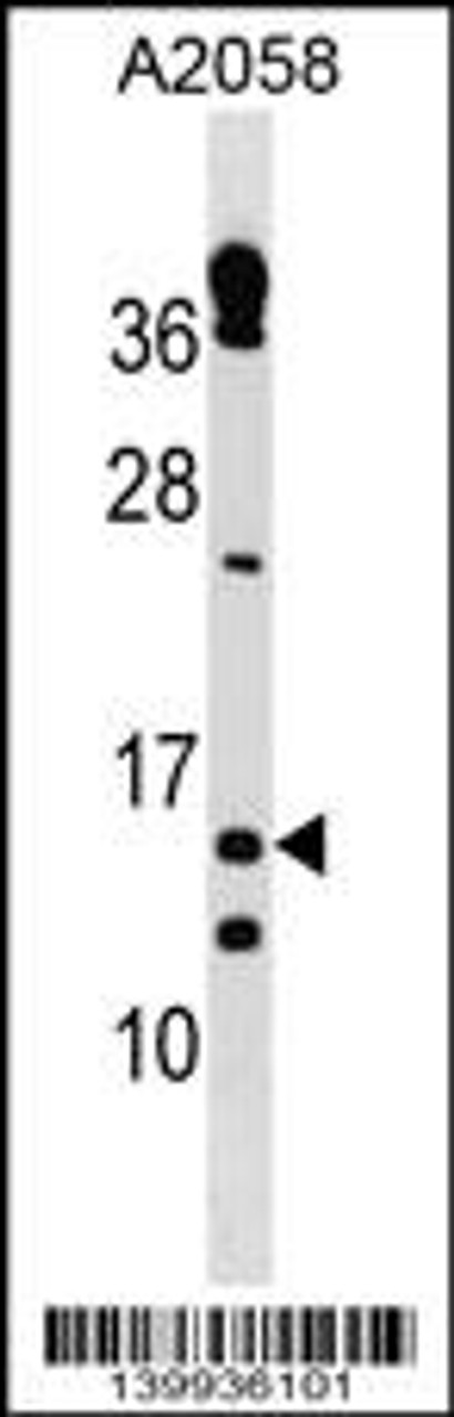 Western blot analysis in A2058 cell line lysates (35ug/lane) .