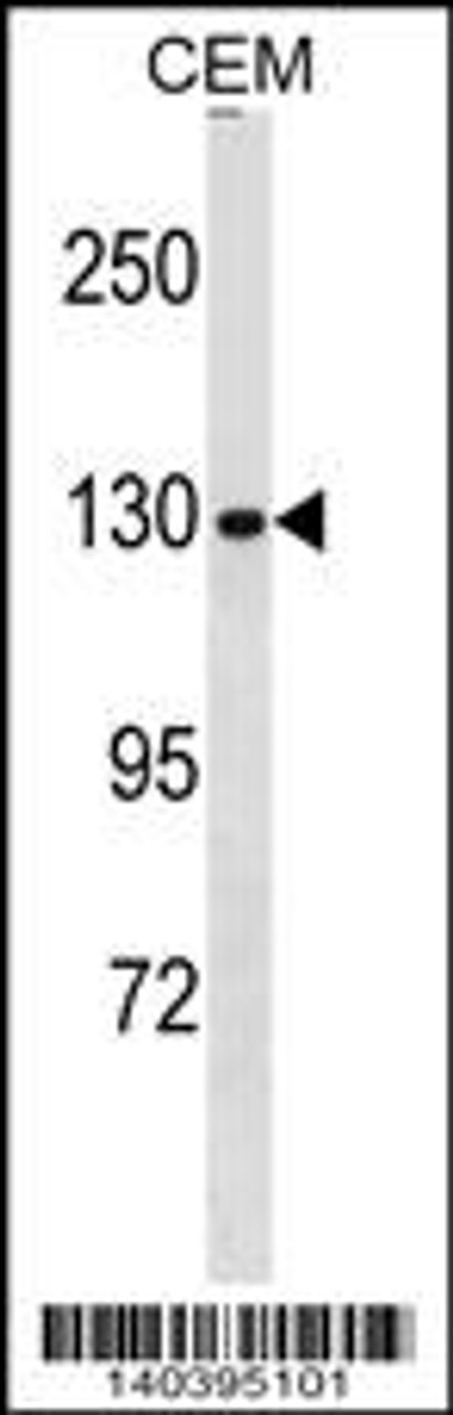 Western blot analysis in CEM cell line lysates (35ug/lane) .