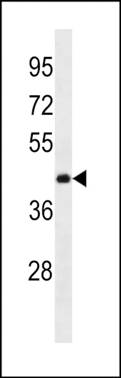 Western blot analysis in A375 cell line lysates (35ug/lane) .