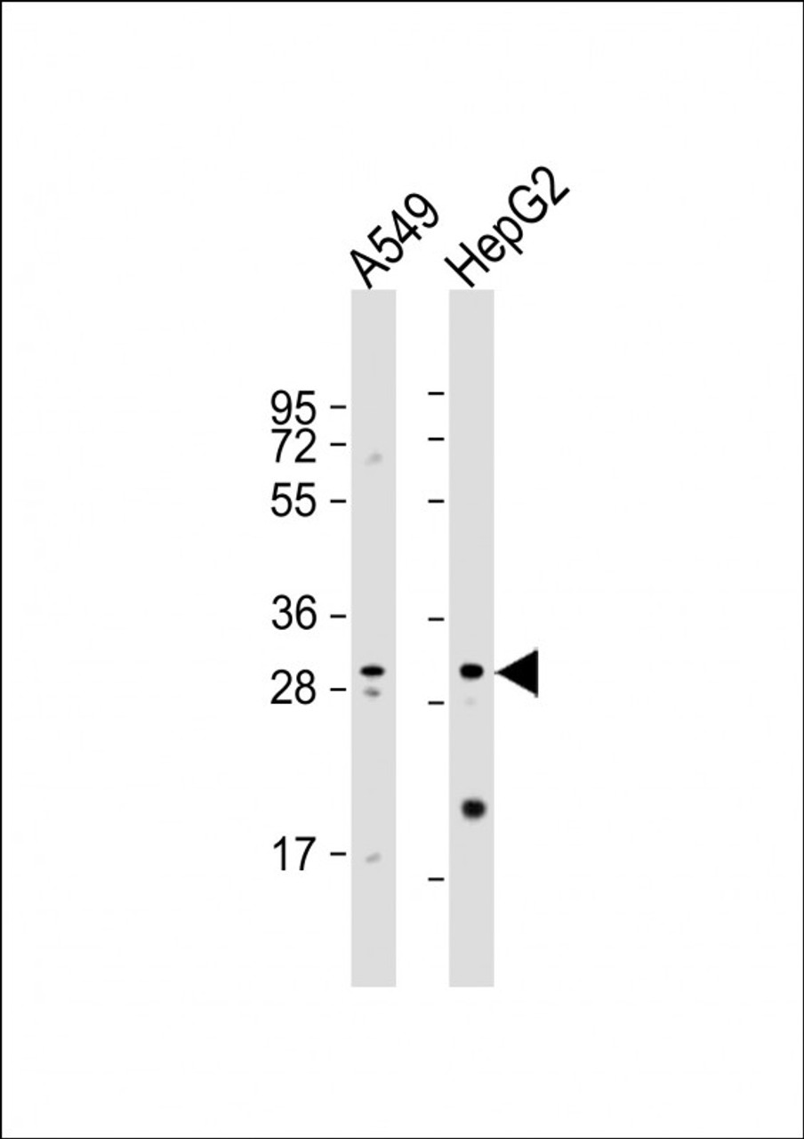 Western Blot at 1:1000 dilution Lane 1: A549 whole cell lysate Lane 2: HepG2 whole cell lysate Lysates/proteins at 20 ug per lane.