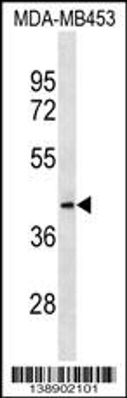 Western blot analysis in MDA-MB453 cell line lysates (35ug/lane) .