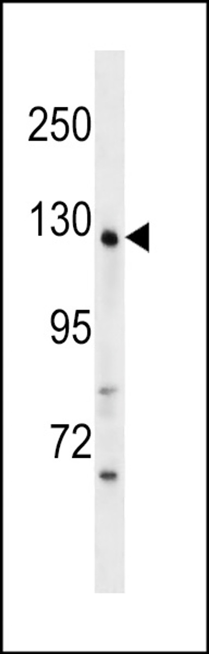 Western blot analysis in mouse kidney tissue lysates (35ug/lane) .