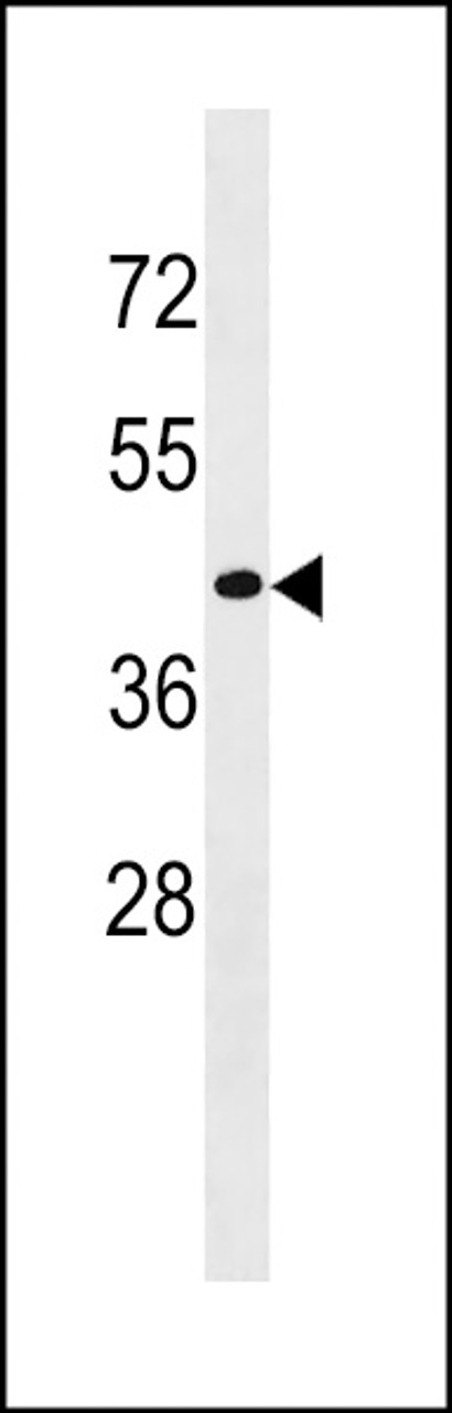 Western blot analysis in MDA-MB453 cell line lysates (35ug/lane) .