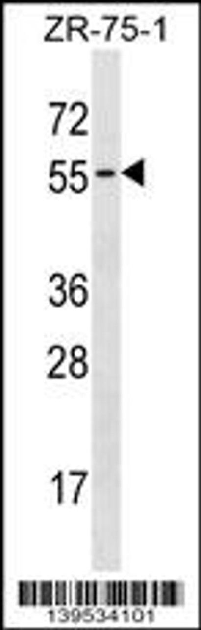 Western blot analysis in ZR-75-1 cell line lysates (35ug/lane) .