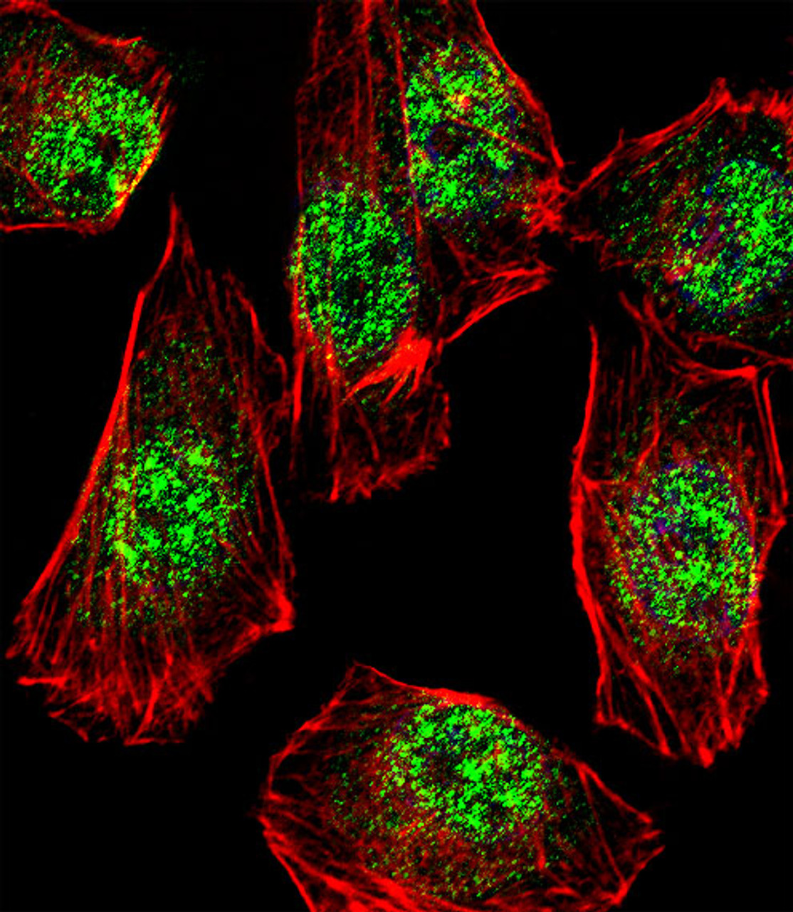 Fluorescent confocal image of A549 cell stained with RHOXF2B Antibody .A549 cells were fixed with 4% PFA (20 min) , permeabilized with Triton X-100 (0.1%, 10 min) , then incubated with RHOXF2B primary antibody (1:25) . For secondary antibody, Alexa Fluor 488 conjugated donkey anti-rabbit antibody (green) was used (1:400) .Cytoplasmic actin was counterstained with Alexa Fluor 555 (red) conjugated Phalloidin (7units/ml) . Nuclei were counterstained with DAPI (blue) (10 ug/ml, 10 min) .RHOXF2B immunoreactivity is localized to Nucleus significantly.