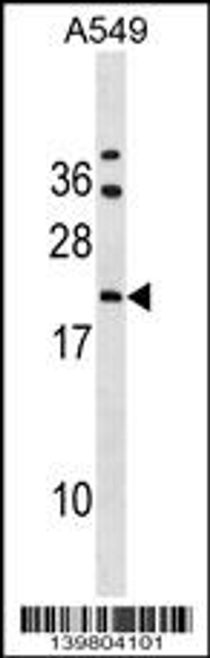 Western blot analysis in A549 cell line lysates (35ug/lane) .