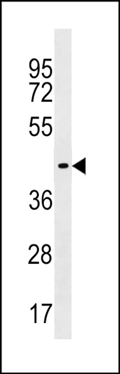 Western blot analysis in human placenta tissue lysates (35ug/lane) .