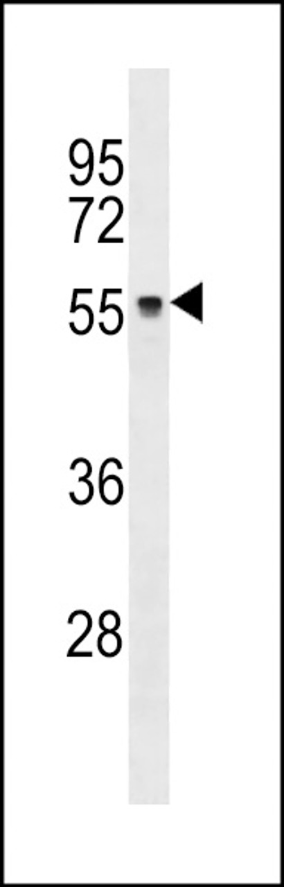 Western blot analysis in MDA-MB231 cell line lysates (35ug/lane) .