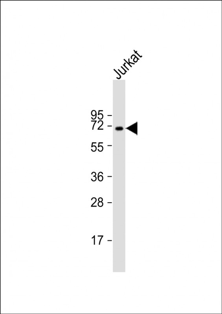 Western Blot at 1:1000 dilution + Jurkat whole cell lysate Lysates/proteins at 20 ug per lane.