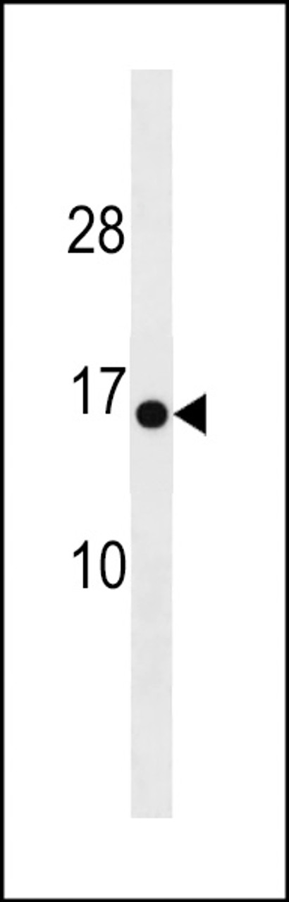 Western blot analysis in mouse heart tissue lysates (35ug/lane) .