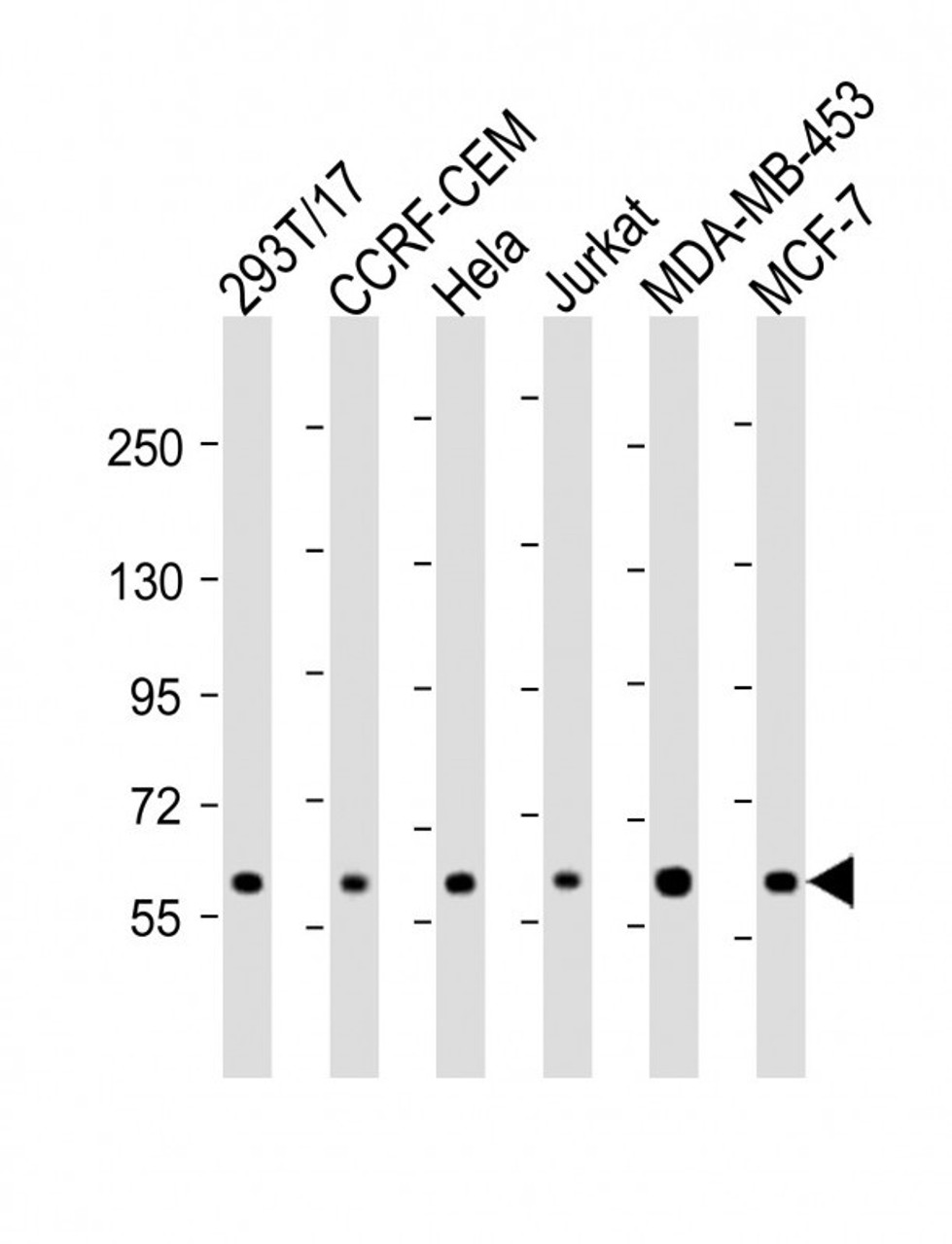 Western Blot at 1:2000 dilution Lane 1: 293T/17 whole cell lysate Lane 2: CCRF-CEM whole cell lysate Lane 3: Hela whole cell lysate Lane 4: Jurkat whole cell lysate Lane 5: MDA-MB-453 whole cell lysate Lane 6: MCF-7 whole cell lysate Lysates/proteins at 20 ug per lane.