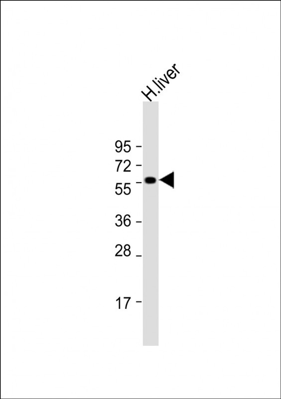 Western Blot at 1:2000 dilution + human liver lysate Lysates/proteins at 20 ug per lane.