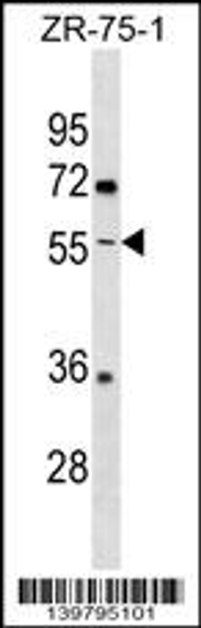 Western blot analysis in ZR-75-1 cell line lysates (35ug/lane) .