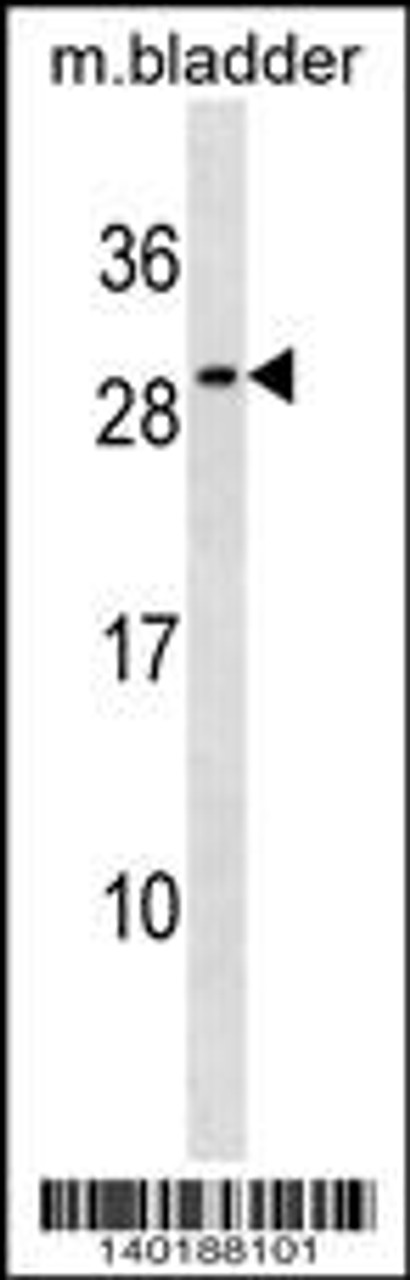 Western blot analysis in mouse bladder tissue lysates (35ug/lane) .