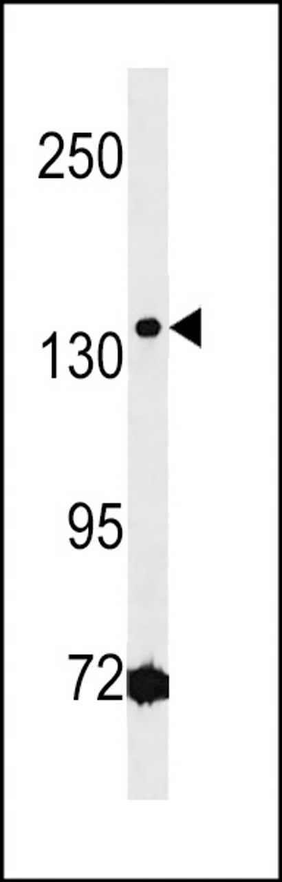 Western blot analysis of lysate from Jurkat cell line, using HMGXB3 Antibody at 1:1000 at each lane.