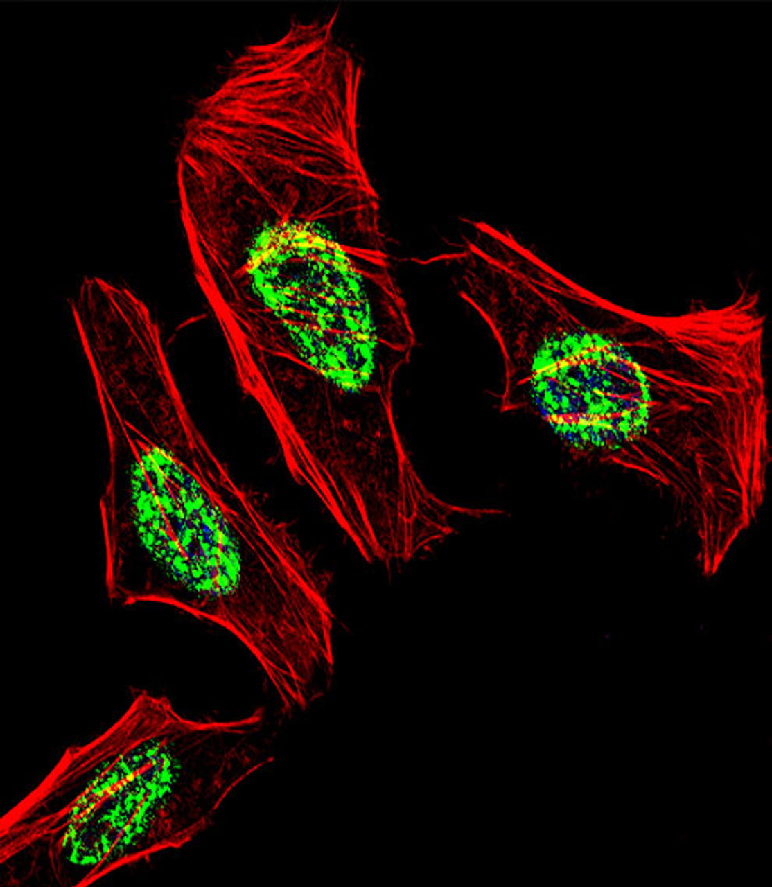 Fluorescent confocal image of Hela cell stained with NR2C2 Antibody .Hela cells were fixed with 4% PFA (20 min) , permeabilized with Triton X-100 (0.1%, 10 min) , then incubated with NR2C2 primary antibody (1:25) . For secondary antibody, Alexa Fluor 488 conjugated donkey anti-rabbit antibody (green) was used (1:400) .Cytoplasmic actin was counterstained with Alexa Fluor 555 (red) conjugated Phalloidin (7units/ml) . Nuclei were counterstained with DAPI (blue) (10 ug/ml, 10 min) . NR2C2 immunoreactivity is localized to Nucleus significantly.