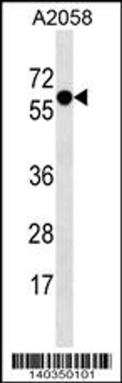 Western blot analysis in A2058 cell line lysates (35ug/lane) .