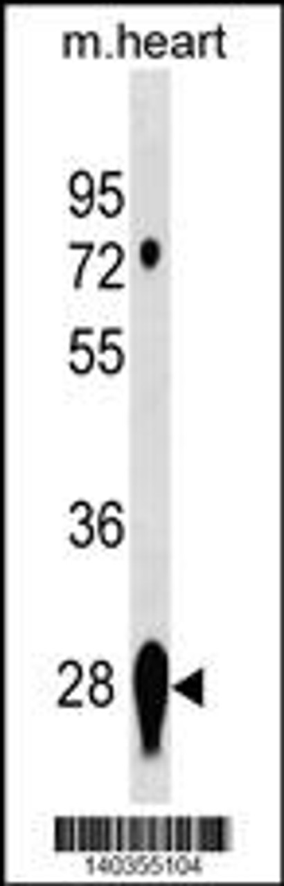 Western blot analysis in mouse heart tissue lysates (35ug/lane) .