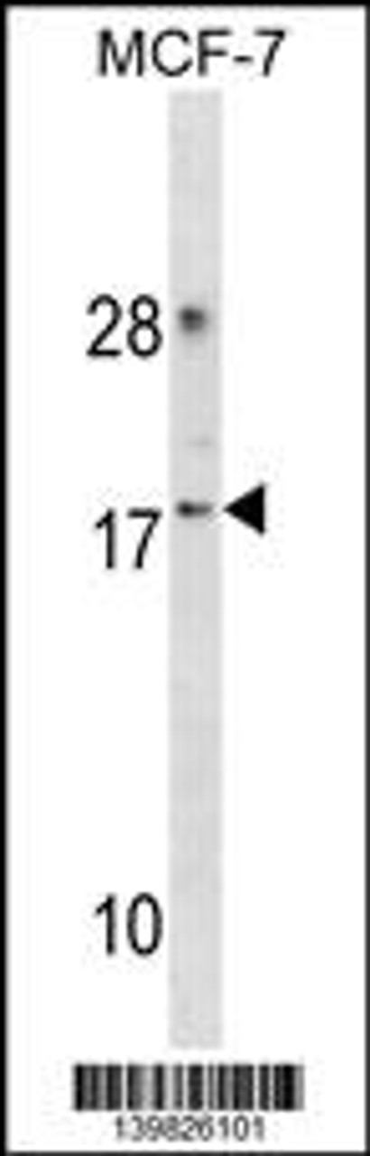 Western blot analysis in MCF-7 cell line lysates (35ug/lane) .