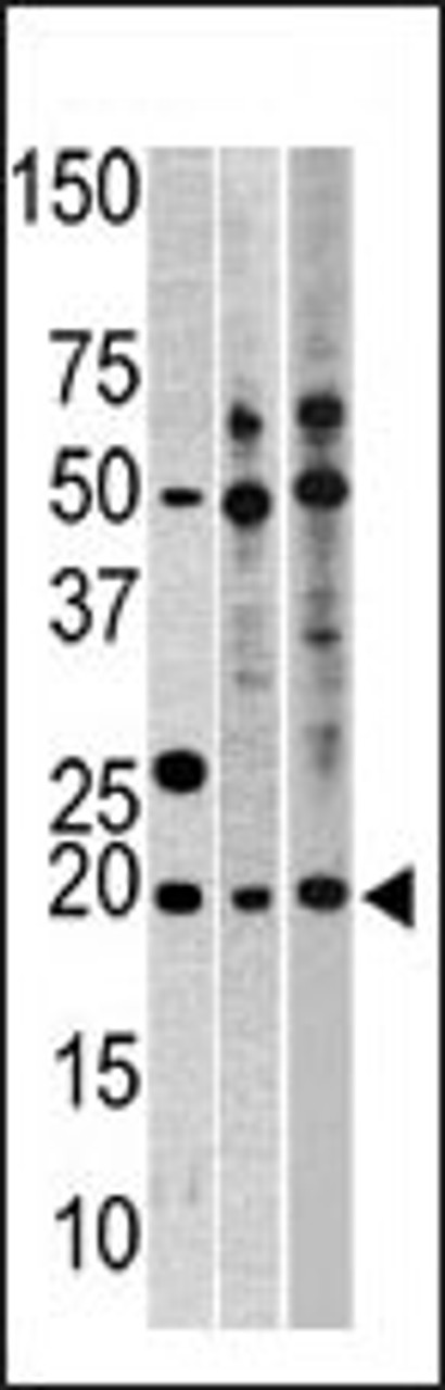 Western blot analysis of anti-RPL23A Pab in, from left to right, CEM, Hela, and HepG2 cell line lysates (35ug/lane)