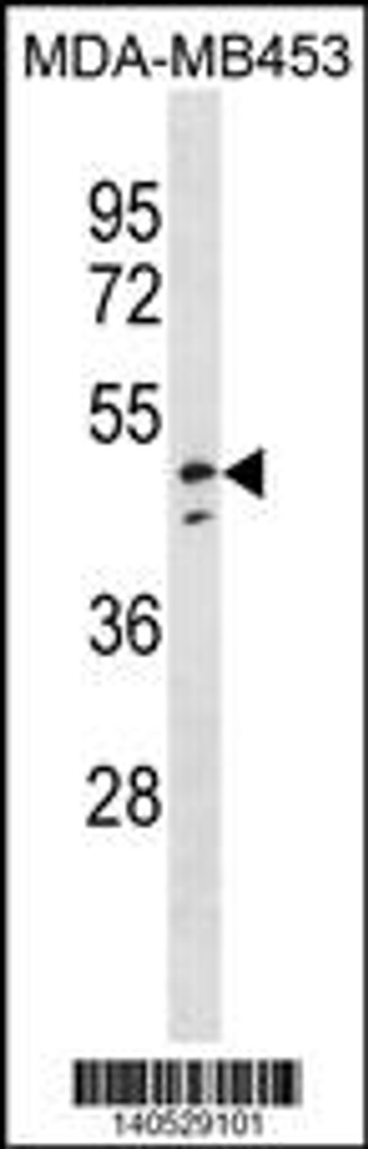 Western blot analysis in MDA-MB453 cell line lysates (35ug/lane) .