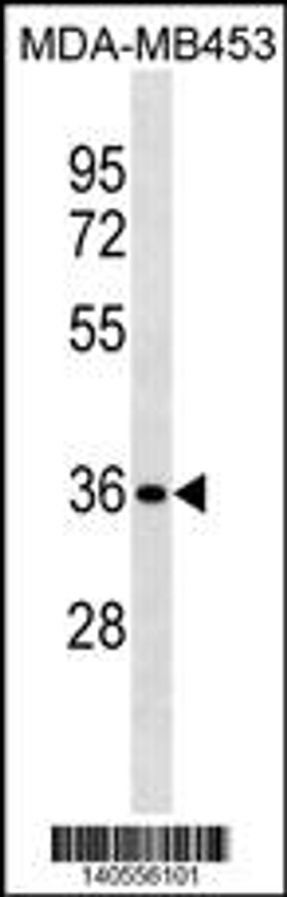 Western blot analysis in MDA-MB453 cell line lysates (35ug/lane) .