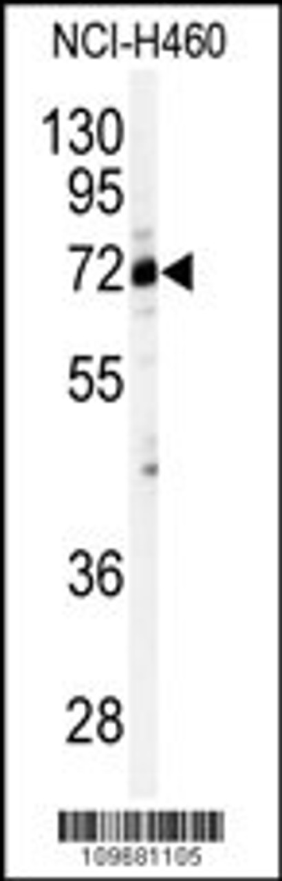 Western blot analysis of anti-CSTF2 Antibody in NCI-H460 cell line lysates (35ug/lane) .