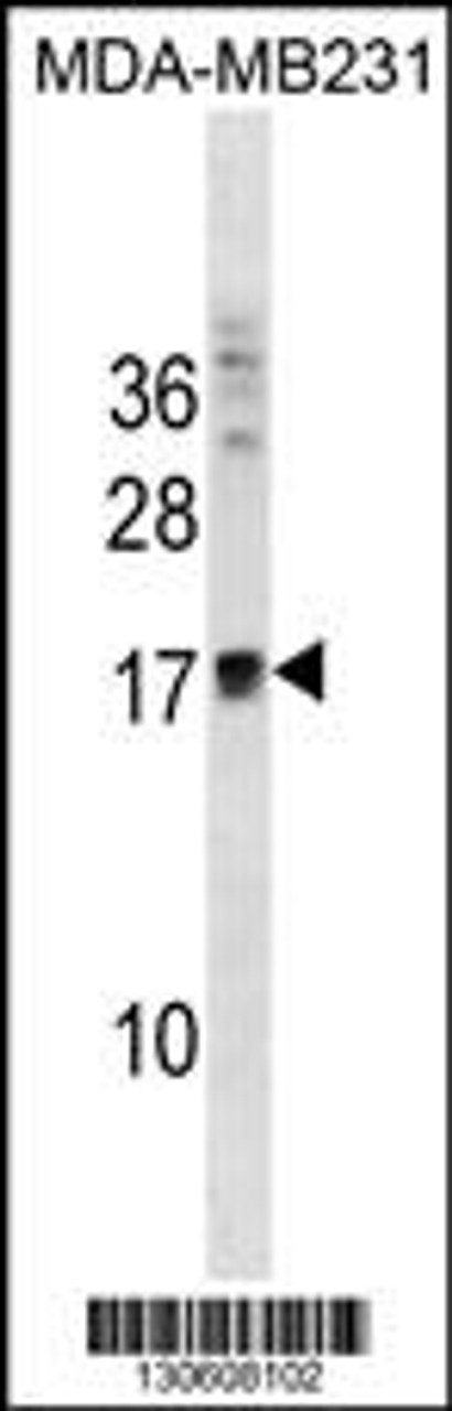 Western blot analysis in MDA-MB231 cell line lysates (35ug/lane) .