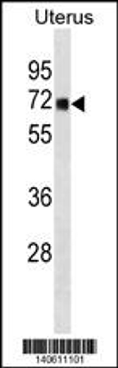 Western blot analysis in human Uterus tissue lysates (35ug/lane) .