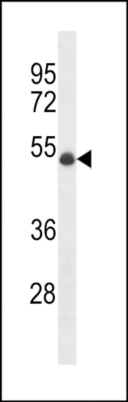 Western blot analysis in MDA-MB231 cell line lysates (35ug/lane) .